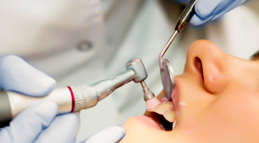 teeth cleaning in mansarovar, jaipur